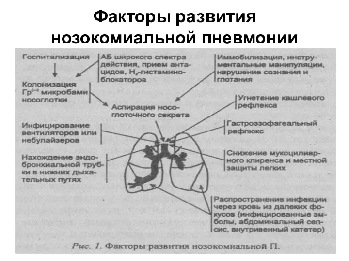 Факторы развития нозокомиальной пневмонии