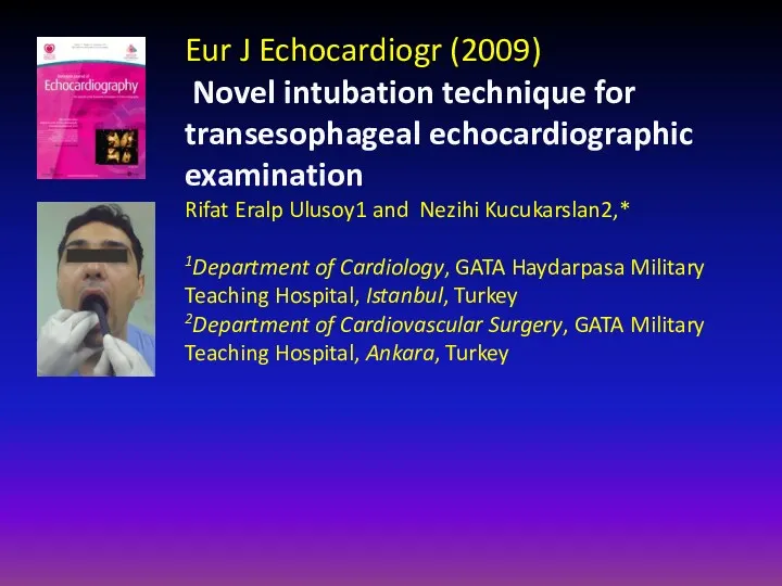 Eur J Echocardiogr (2009) Novel intubation technique for transesophageal echocardiographic