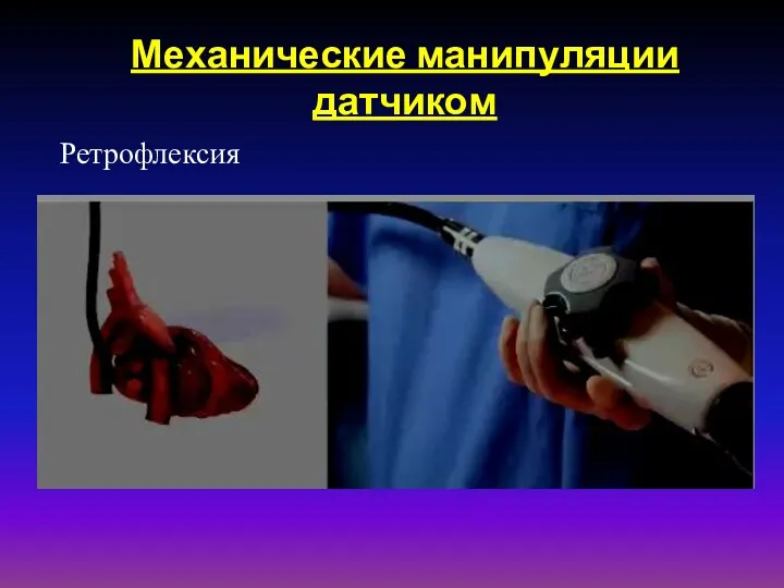 Механические манипуляции датчиком Ретрофлексия