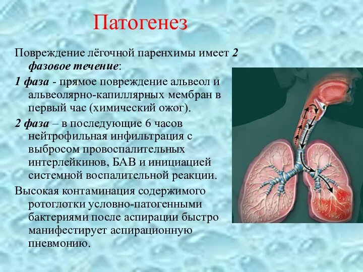 Патогенез Повреждение лёгочной паренхимы имеет 2 фазовое течение: 1 фаза