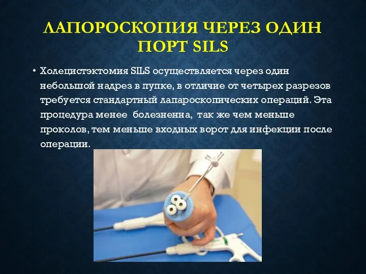 ЛАПОРОСКОПИЯ ЧЕРЕЗ ОДИН ПОРТ SILS Холецистэктомия SILS осуществляется через один