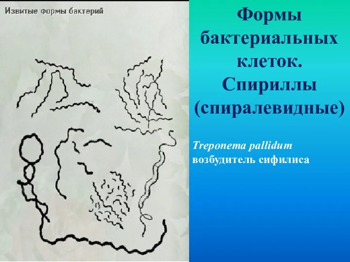 Формы бактериальных клеток. Спириллы (спиралевидные) Treponema pallidum возбудитель сифилиса