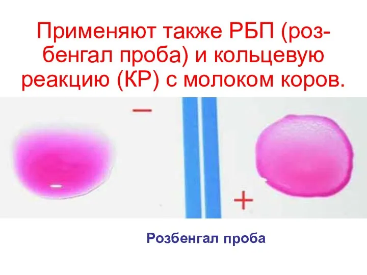 Применяют также РБП (роз-бенгал проба) и кольцевую реакцию (КР) с молоком коров. Розбенгал проба