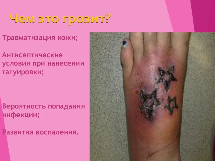 Травматизация кожи; Антисептические условия при нанесении татуировки; Вероятность попадания инфекции; Развития воспаления.