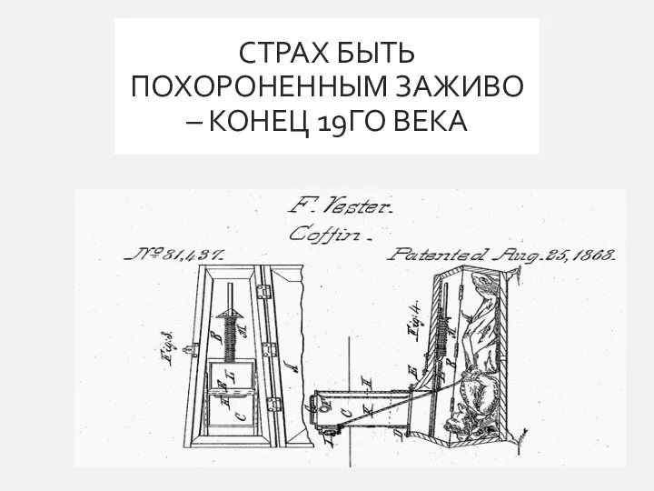 СТРАХ БЫТЬ ПОХОРОНЕННЫМ ЗАЖИВО – КОНЕЦ 19ГО ВЕКА