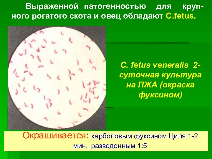 Окрашивается: карболовым фуксином Циля 1-2 мин, разведенным 1:5 Выраженной патогенностью