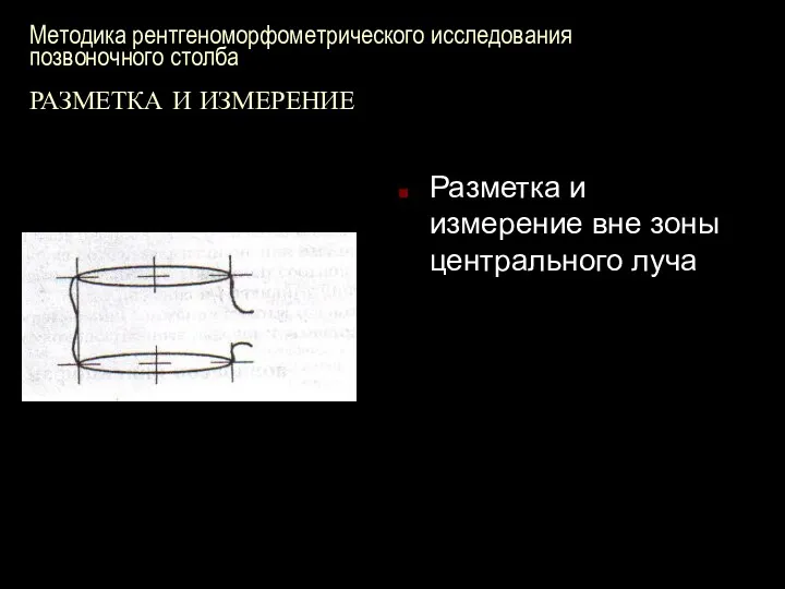 Методика рентгеноморфометрического исследования позвоночного столба РАЗМЕТКА И ИЗМЕРЕНИЕ Разметка и