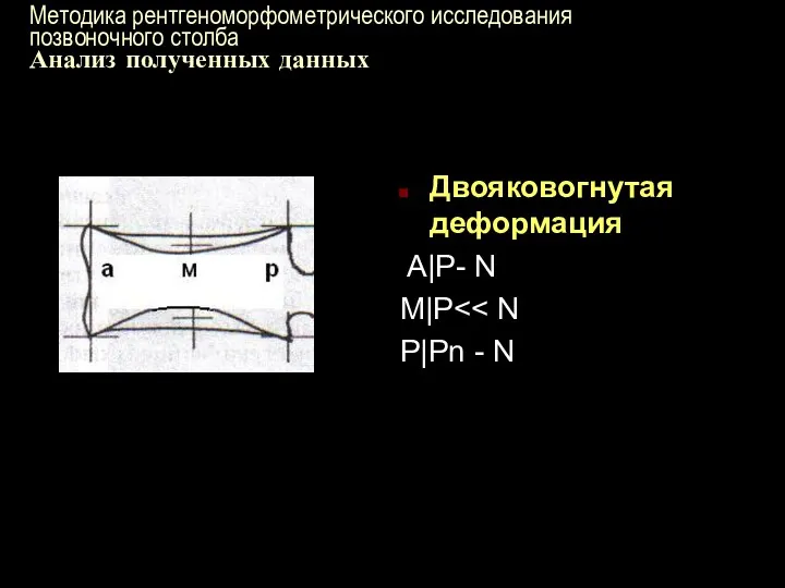 Методика рентгеноморфометрического исследования позвоночного столба Анализ полученных данных Двояковогнутая деформация A|P- N M|P P|Pn - N