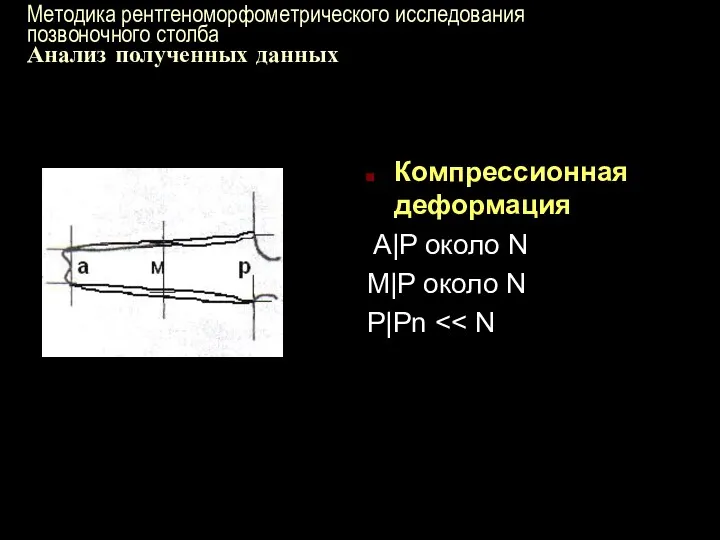 Методика рентгеноморфометрического исследования позвоночного столба Анализ полученных данных Компрессионная деформация