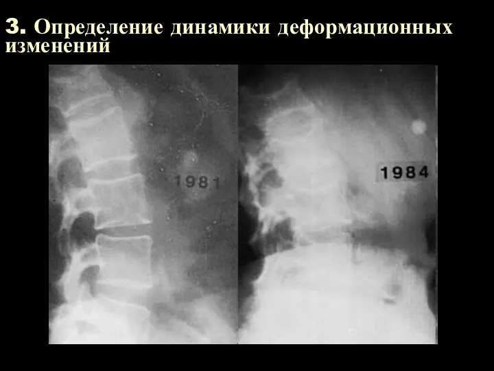 3. Определение динамики деформационных изменений