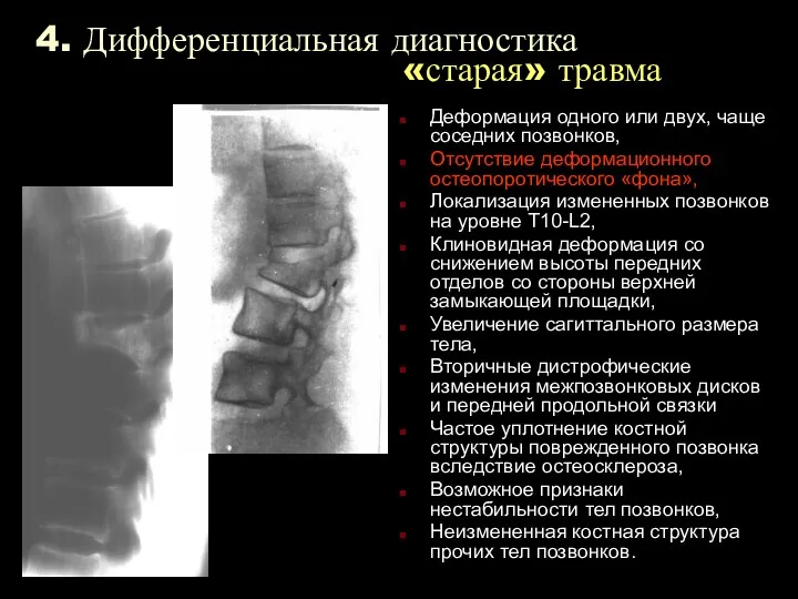 4. Дифференциальная диагностика «старая» травма Деформация одного или двух, чаще