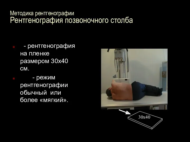 Методика рентгенографии Рентгенография позвоночного столба - рентгенография на пленке размером