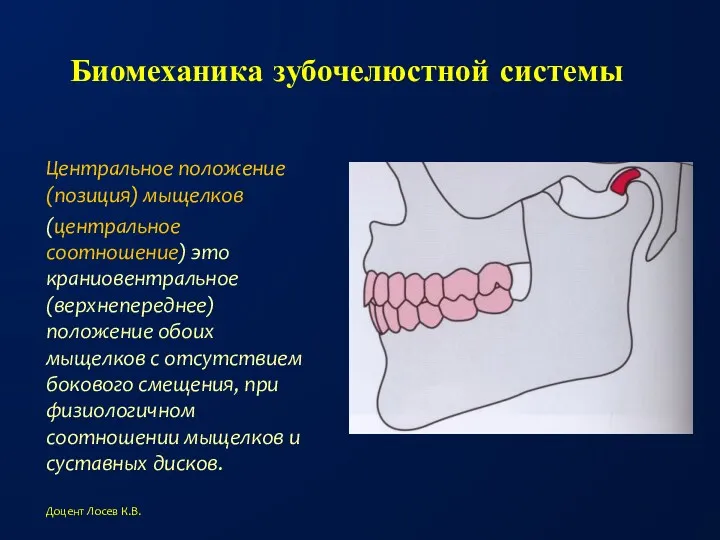 Биомеханика зубочелюстной системы Центральное положение (позиция) мыщелков (центральное соотношение) это краниовентральное (верхнепереднее) положение