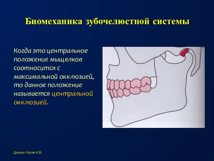 Биомеханика зубочелюстной системы Когда это центральное положение мыщелков соотносится с максимальной окклюзией, то