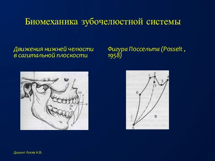 Биомеханика зубочелюстной системы Движения нижней челюсти в сагитальной плоскости Фигура Поссельта (Posselt ,