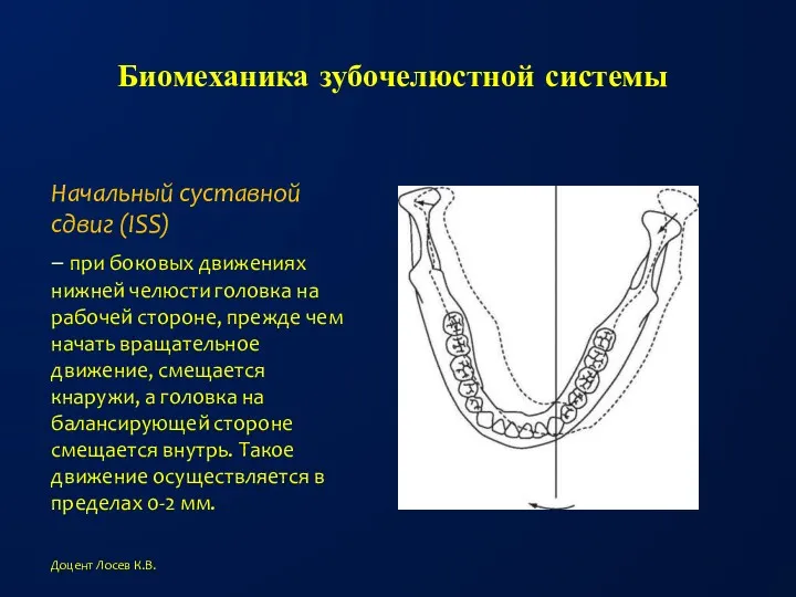 Биомеханика зубочелюстной системы Начальный суставной сдвиг (ISS) – при боковых движениях нижней челюсти