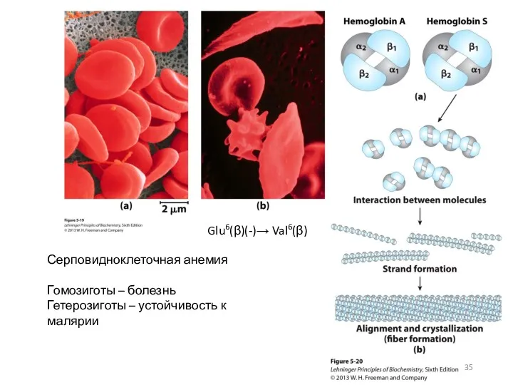 Glu6(β)(-)→ Val6(β) Серповидноклеточная анемия Гомозиготы – болезнь Гетерозиготы – устойчивость к малярии