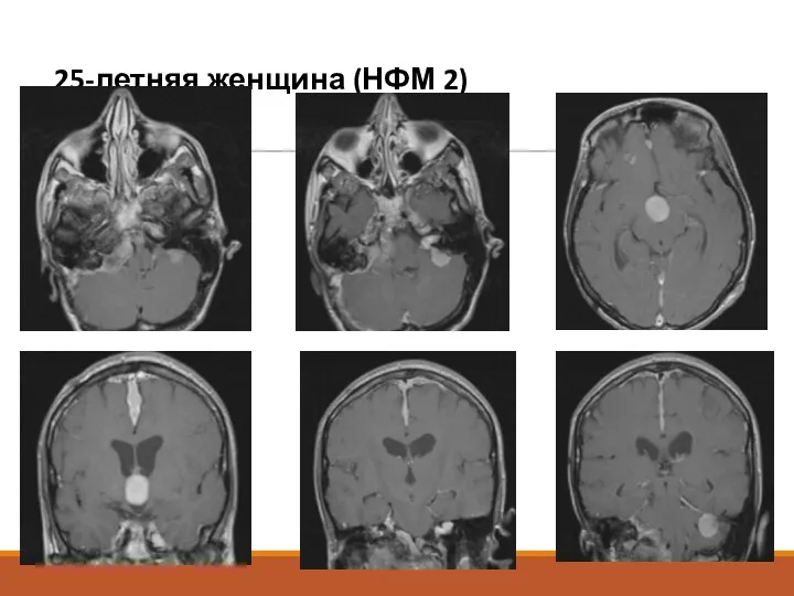 25-летняя женщина (НФМ 2)