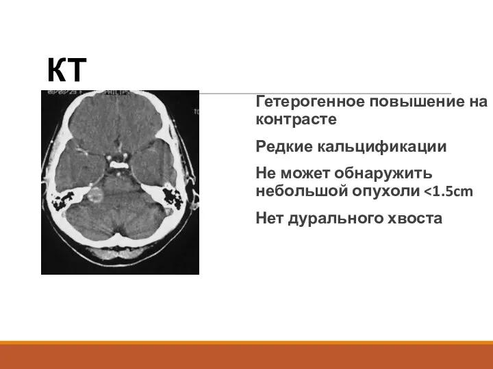 КТ Гетерогенное повышение на контрасте Редкие кальцификации Не может обнаружить небольшой опухоли Нет дурального хвоста