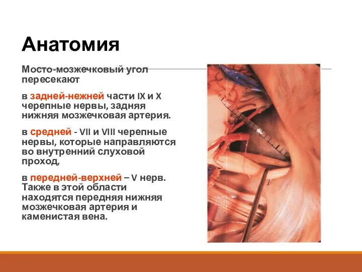 Анатомия Мосто-мозжечковый угол пересекают в задней-нежней части IX и X