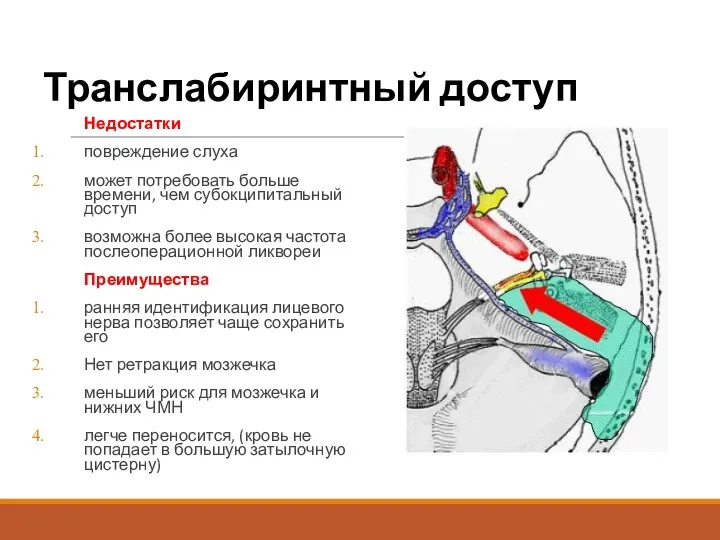 Транслабиринтный доступ Недостатки повреждение слуха может потребовать больше времени, чем