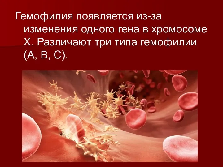 Гемофилия появляется из-за изменения одного гена в хромосоме X. Различают три типа гемофилии (A, B, C).