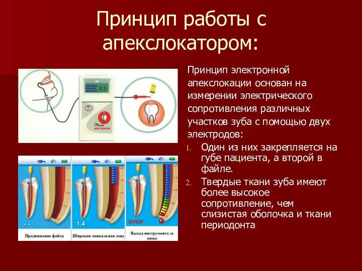 Принцип работы с апекслокатором: Принцип электронной апекслокации основан на измерении