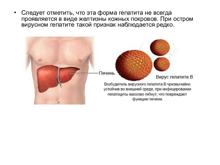 Следует отметить, что эта форма гепатита не всегда проявляется в