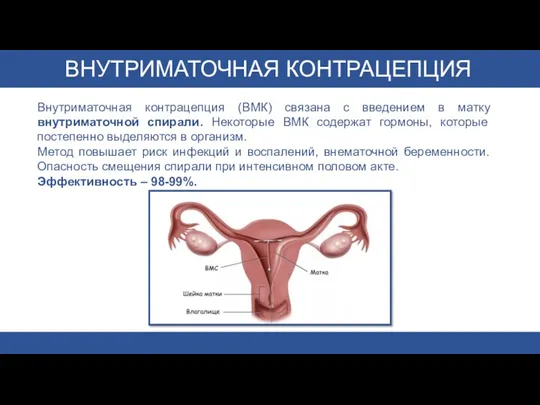 ВНУТРИМАТОЧНАЯ КОНТРАЦЕПЦИЯ Внутриматочная контрацепция (ВМК) связана с введением в матку