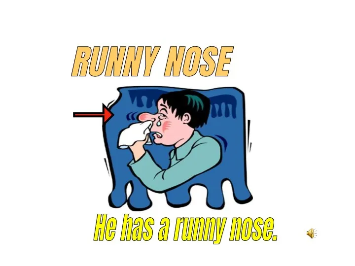 RUNNY NOSE He has a runny nose.
