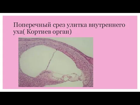 Поперечный срез улитка внутреннего уха( Кортиев орган)