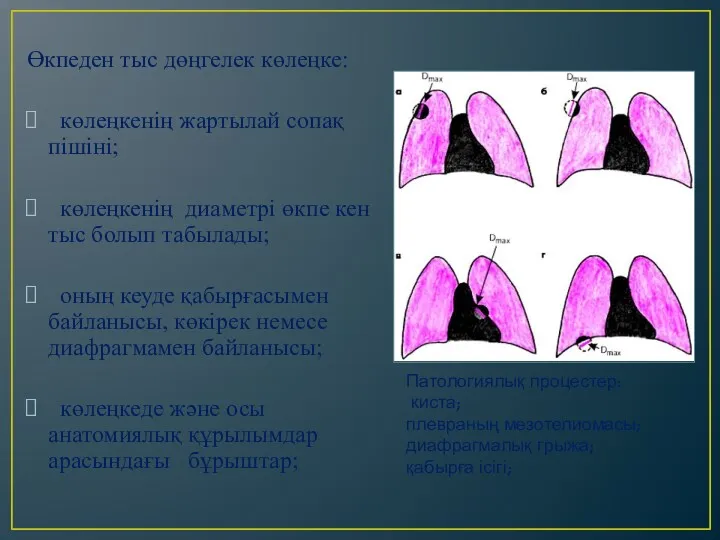 Өкпеден тыс дөңгелек көлеңке: көлеңкенің жартылай сопақ пішіні; көлеңкенің диаметрі