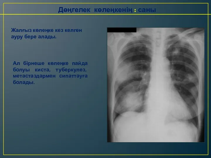 Дөңгелек көлеңкенің : саны Жалғыз көлеңке кез келген ауру бере