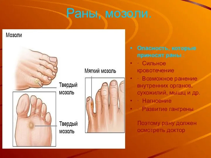 Раны, мозоли. Опасность, которые приносят раны : · Сильное кровотечение