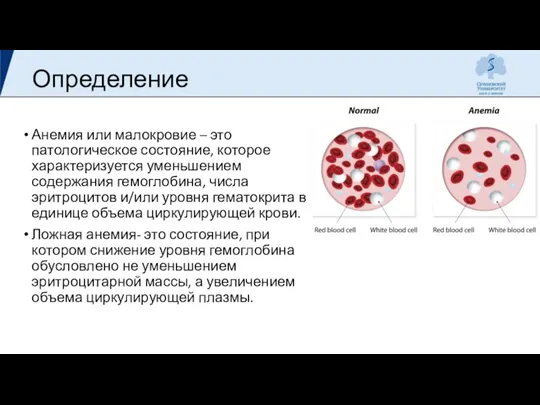 Определение Анемия или малокровие – это патологическое состояние, которое характеризуется