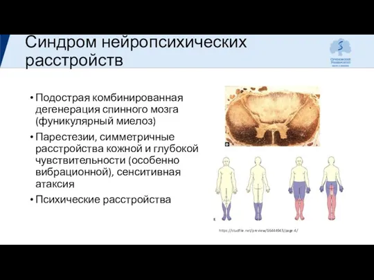 Синдром нейропсихических расстройств Подострая комбинированная дегенерация спинного мозга (фуникулярный миелоз)