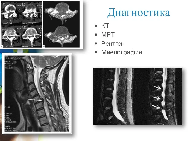 Диагностика КТ МРТ Рентген Миелография