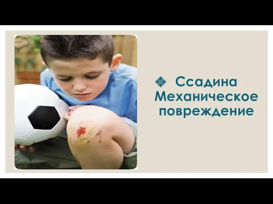 Ссадина Механическое повреждение