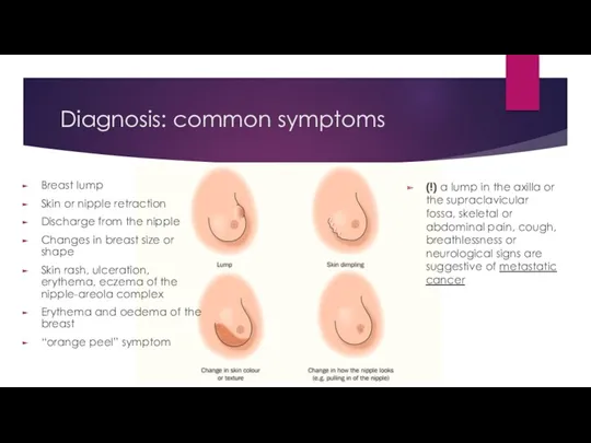 Diagnosis: common symptoms Breast lump Skin or nipple retraction Discharge