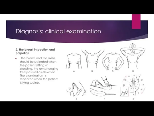 Diagnosis: clinical examination 2. The breast inspection and palpation The