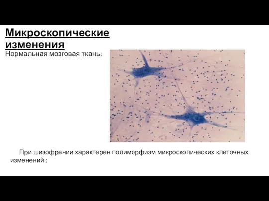 Микроскопические изменения Нормальная мозговая ткань: При шизофрении характерен полиморфизм микроскопических клеточных изменений :