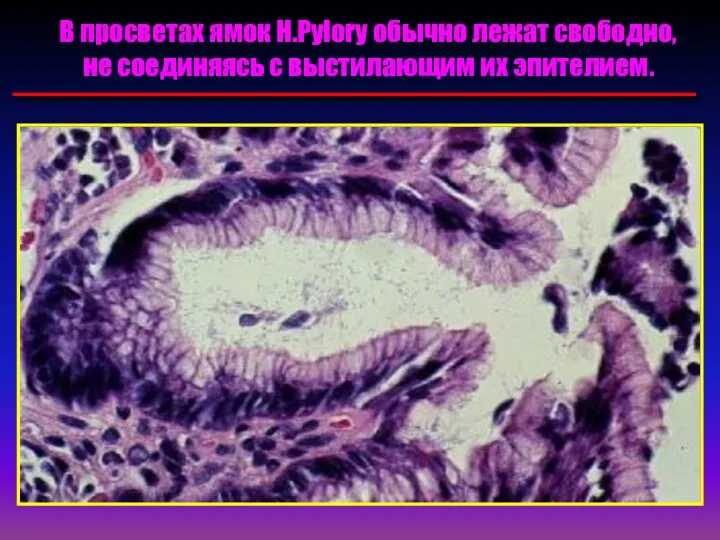В просветах ямок H.Pylory обычно лежат свободно, не соединяясь с выстилающим их эпителием.