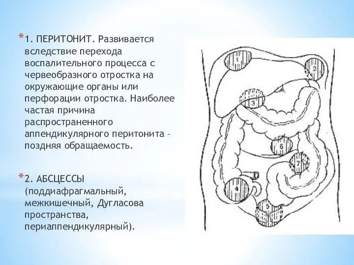 1. ПЕРИТОНИТ. Развивается вследствие перехода воспалительного процесса с червеобразного отростка