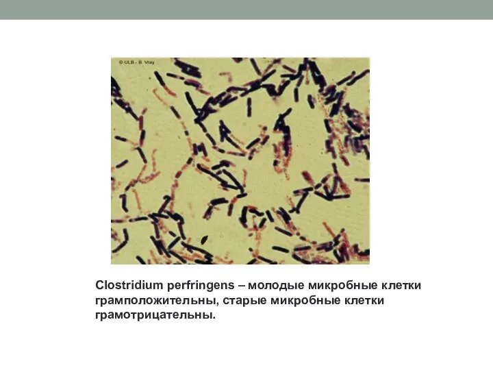 Clostridium perfringens – молодые микробные клетки грамположительны, старые микробные клетки грамотрицательны.