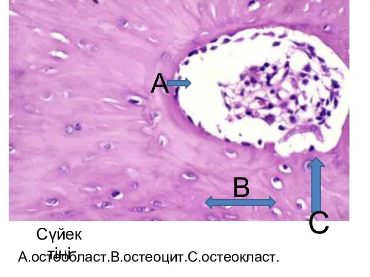 А В С А.остеобласт.В.остеоцит.С.остеокласт. Сүйек тіні