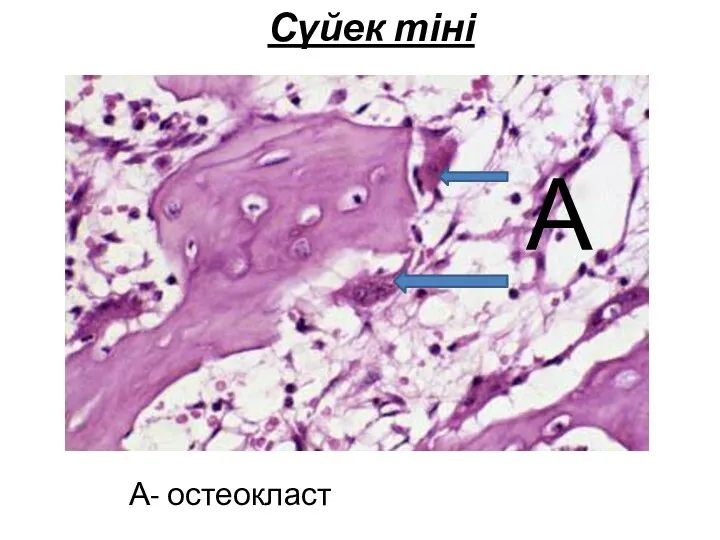 Сүйек тіні А- остеокласт А