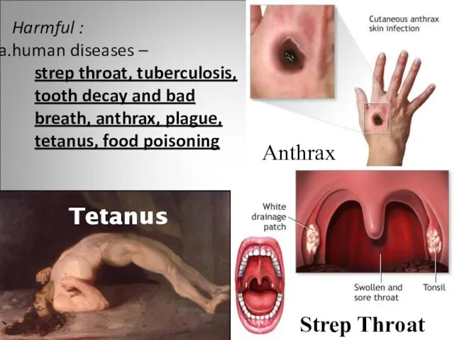 Harmful : human diseases – strep throat, tuberculosis, tooth decay