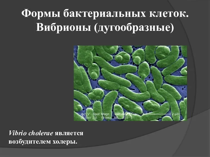 Формы бактериальных клеток. Вибрионы (дугообразные) Vibrio cholerae является возбудителем холеры.