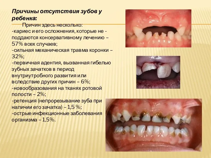 Причины отсутствия зубов у ребенка: Причин здесь несколько: -кариес и