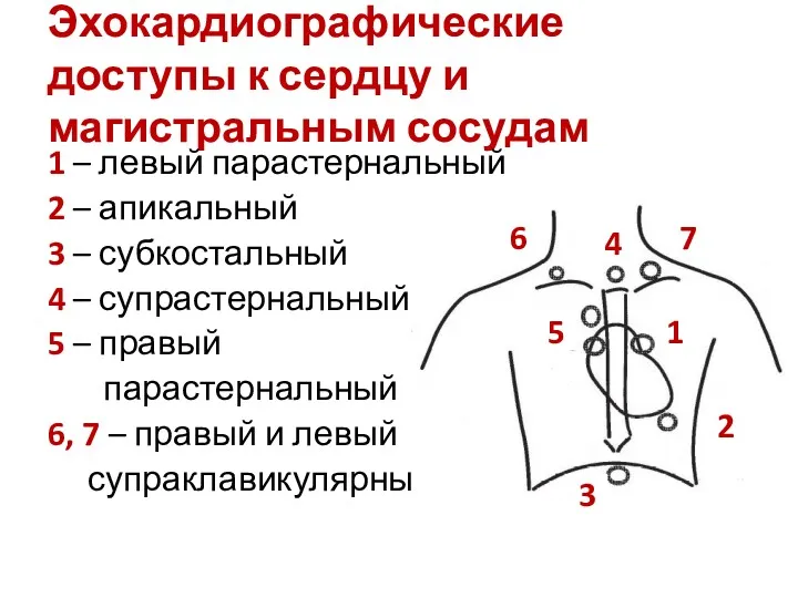 Эхокардиографические доступы к сердцу и магистральным сосудам 1 – левый